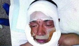 爆料博主毁容事件视频播放